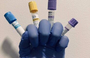Коли УЗД не показує пухлину, а вона є — роль цитології у діагностиці новоутворень